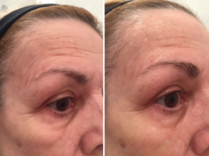 coolifting-before-and-after