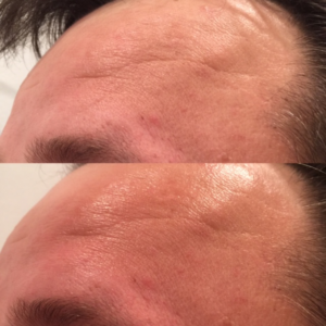 coolifting-before-and-after