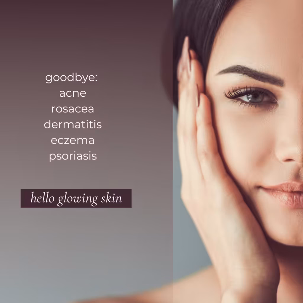 Rosacea root cause treatment functional medicine approach at Unique Verve