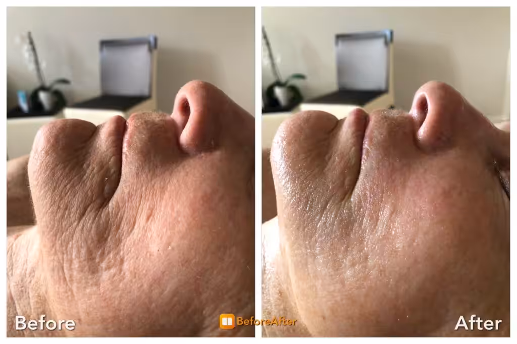 Ultimate Anti-Aging Facial