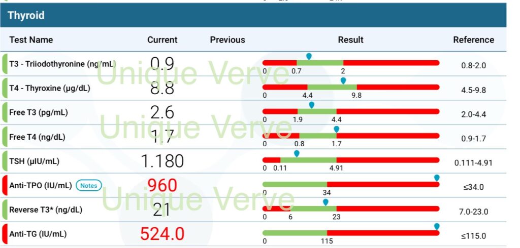 Thyroid Lab Missteps Explained