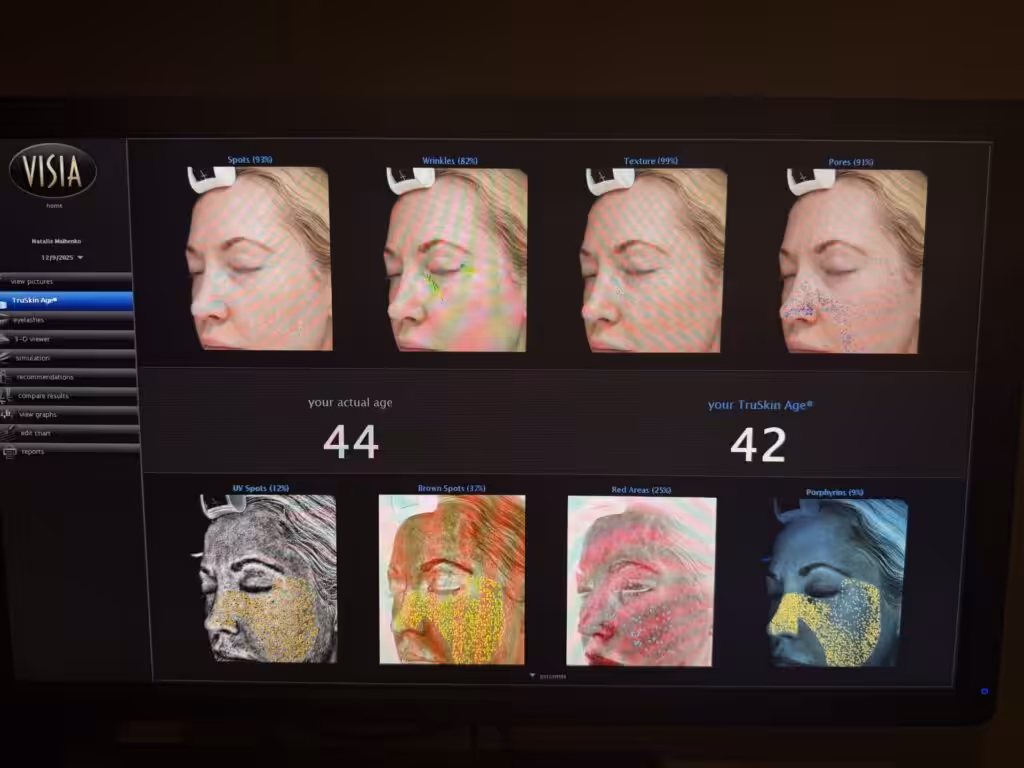 Cellular Functional Medicine Detox for Hyperpigmentation
