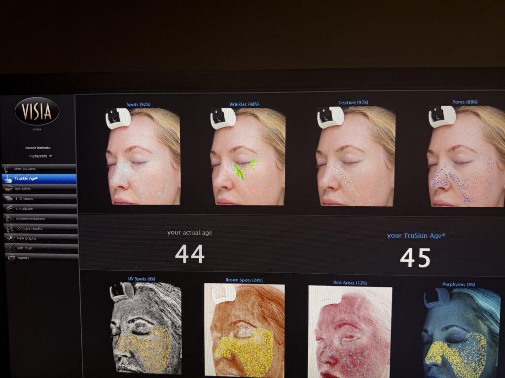 Cellular Functional Medicine Detox for Hyperpigmentation