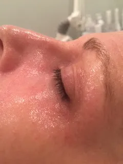 after Personalized skincare treatment
