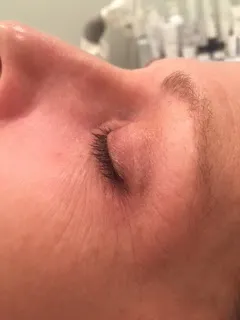 before Personalized skincare treatment