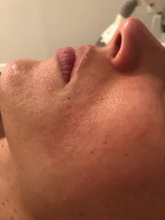 Real client skincare, after