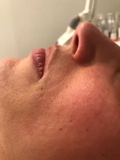 Real client skincare, before