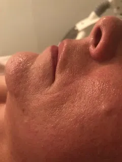 Functional dermatology client treatment, after