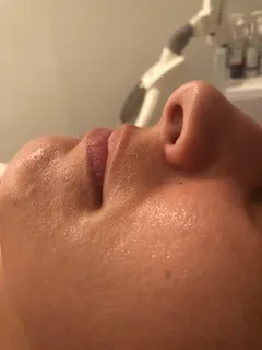 results of Personalized skincare treatment