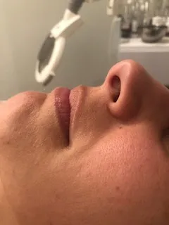 before Personalized skincare treatment