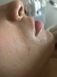 After functional dermatology treatment