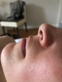 Personalized skincare treatment by Unique Verve