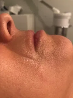 Before skincare treatment image