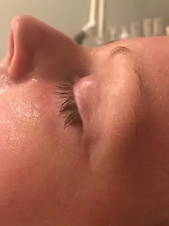 after Functional dermatology