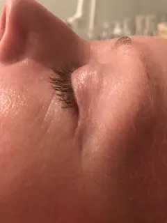 before Functional dermatology