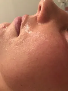 after skincare treatment with unique verve