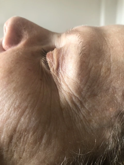 Before anti-aging skincare treatment