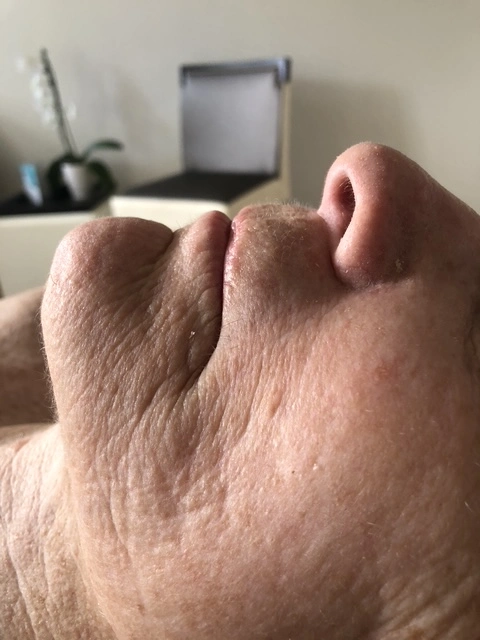 Before professional facial treatment