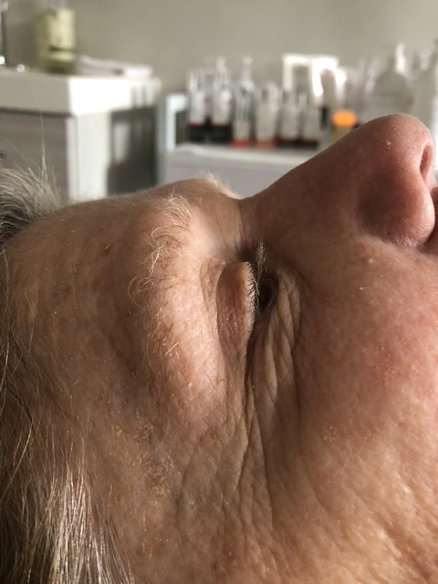 Before facial skincare treatment results
